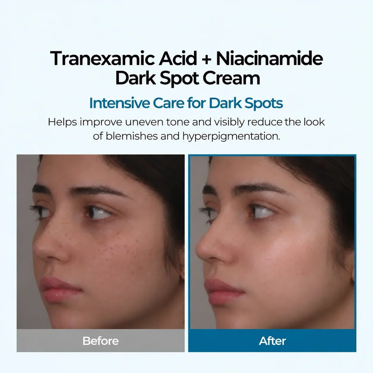 Tranexamic Acid + Niacinamide Dark Spot Cream