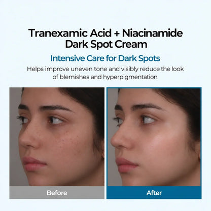 Tranexamic Acid + Niacinamide Dark Spot Cream