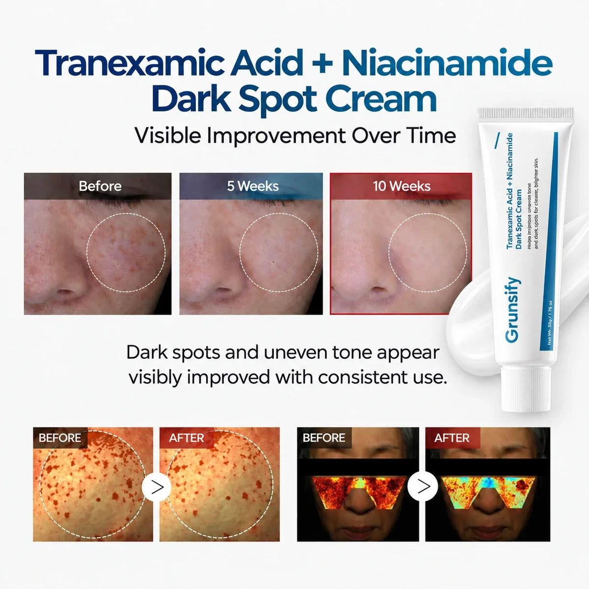 Tranexamic Acid + Niacinamide Dark Spot Cream
