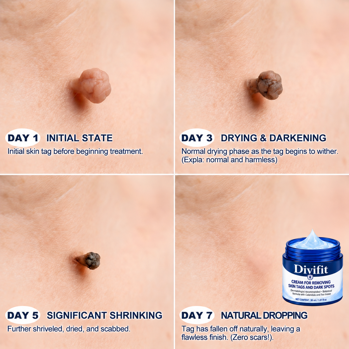 Divifit® Focused Care for Skin Tags & Spots.