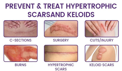 🔥 LIMITED SPECIAL OFFER Grunsify Scar Repair Gel