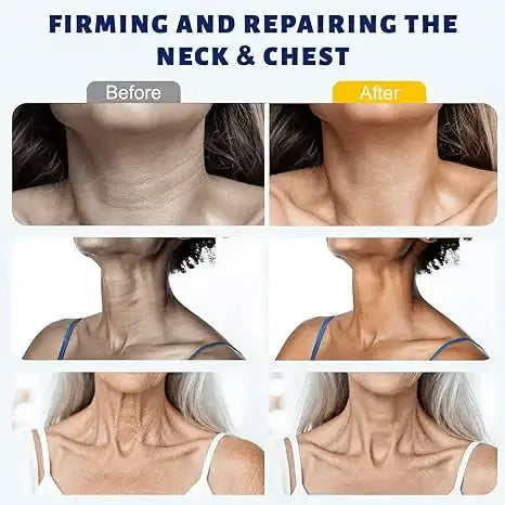 Instant Neck Lift Cream — 🧴 Infused with Retinol & Hyaluronic Acid | Firms the Neck, Reduces Wrinkles & Double Chin
