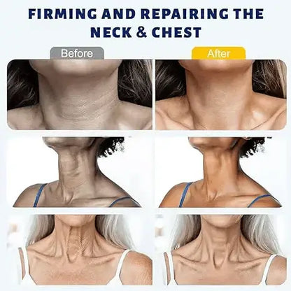 Instant Neck Lift Cream — 🧴 Infused with Retinol & Hyaluronic Acid | Firms the Neck, Reduces Wrinkles & Double Chin