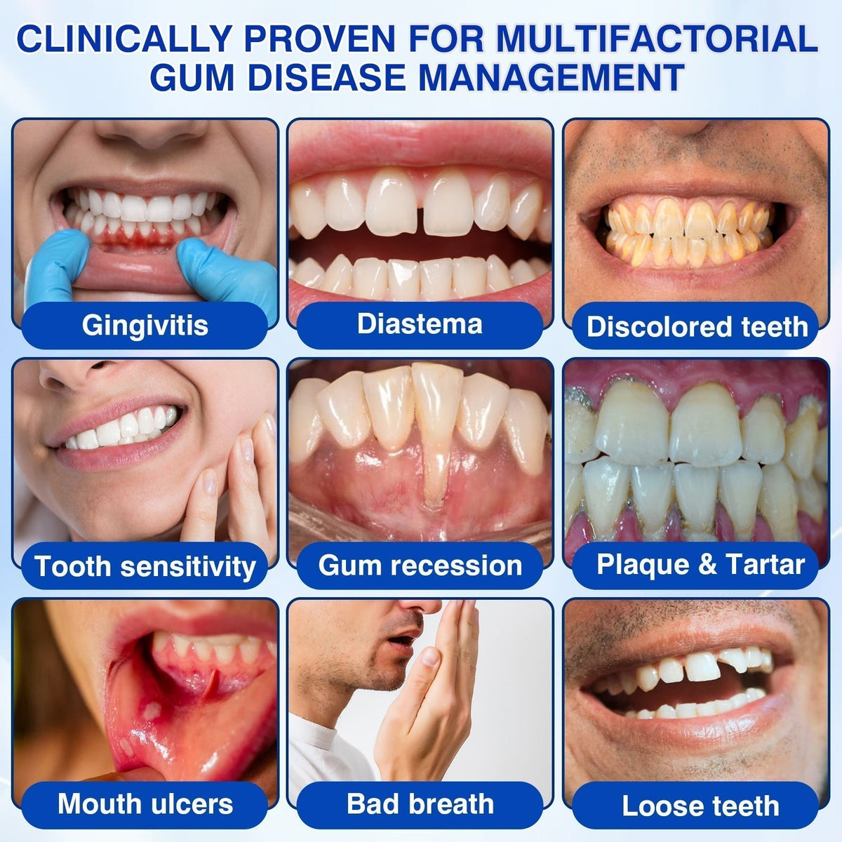 🛡️BBOJI®GumRevive Periodontal Repair Gel🦷