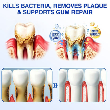 🛡️BBOJI®DenPerm Cavity-Repair Natural Enamel Filling Gel
