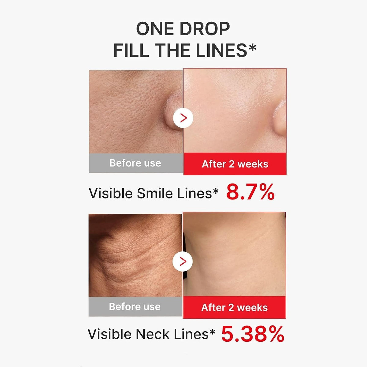 Wash-off Resurfacing Serum