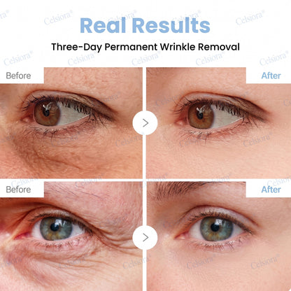 💧🔥UK HOT SALE Celsiora® PDRN Anti-Wrinkle Shot – Lift & Firming Cream