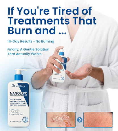 ✅ Official Store:  🔥Grunsify NanoLipo HPV Genital Warts Eraser Cream Plus+