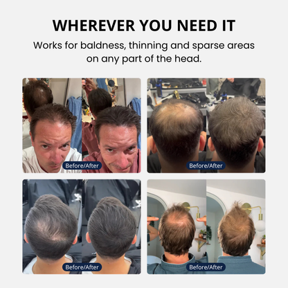 🔥Last Day 50% OFF⏰Hair Density Cream