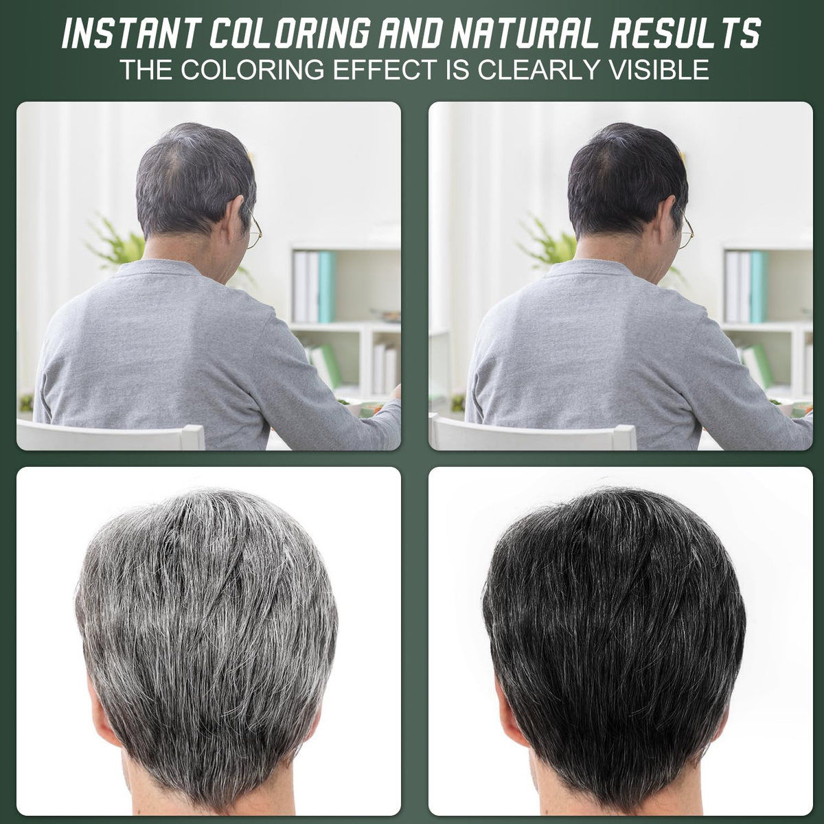 🔥🎁Last Day-Buy 1 Get 1 Free 🔥Botanical Fruit Essence Hair Dye Cream Nourishing Gray Coverage