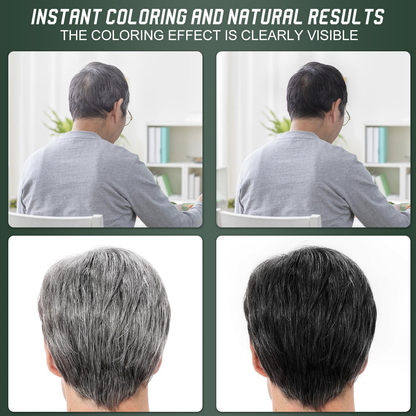 🔥🎁Last Day-Buy 1 Get 1 Free 🔥Botanical Fruit Essence Hair Dye Cream Nourishing Gray Coverage