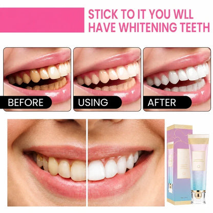 🔥Fast-Acting Niacinamide Whitening Toothpaste