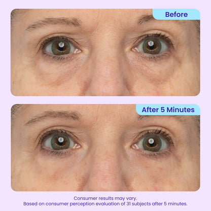 Instant Lift Eye Gel for Puffiness & Wrinkles RESULTS IN AS LITTLE AS 5 MINUTES