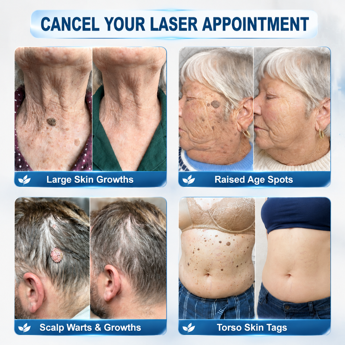 Divifit® Focused Care for Skin Tags & Spots.
