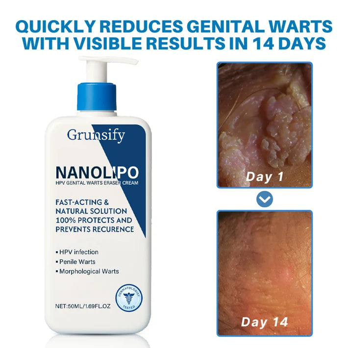 Grunsify NanoLipo HPV Genital Warts Eraser Cream Plus+