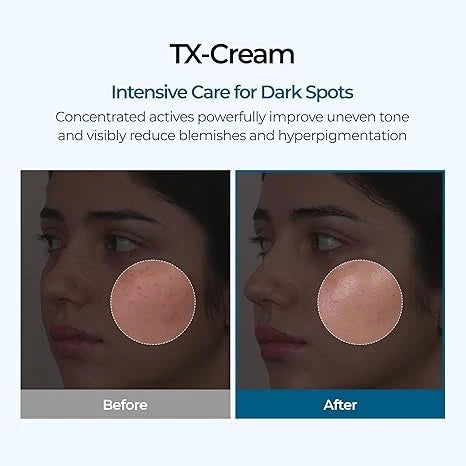 Divifit Tranexamic Cream | Skin freckle Cream, Anti-pigmetation For All Skin