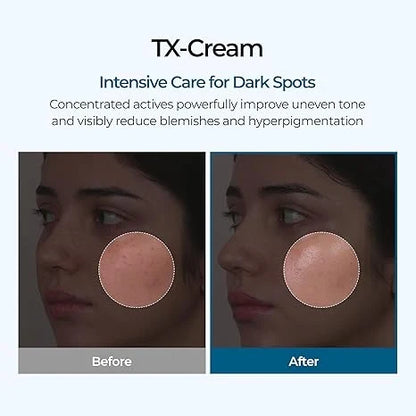 Divifit Tranexamic Cream | Skin freckle Cream, Anti-pigmetation For All Skin