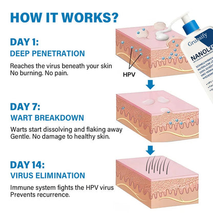 ✅ Official Store:  🔥Grunsify NanoLipo HPV Genital Warts Eraser Cream Plus+