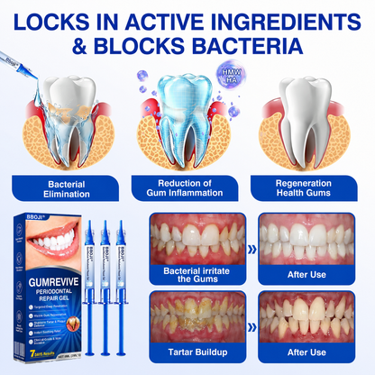 🛡️BBOJI®DenPerm Cavity-Repair Natural Enamel Filling Gel