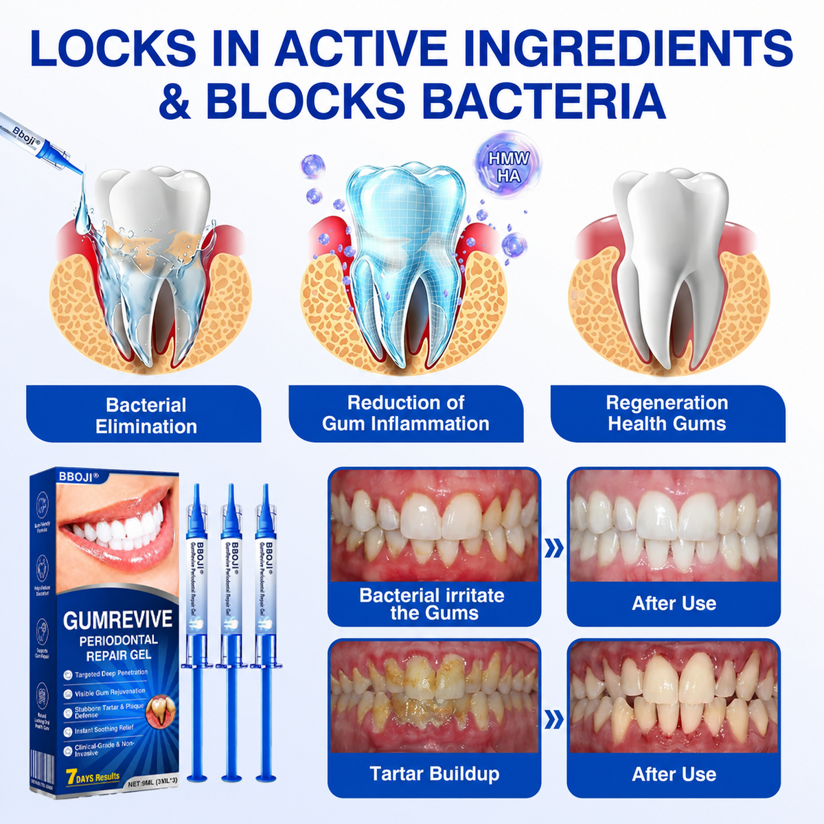 🛡️BBOJI®GumRevive Periodontal Repair Gel🦷