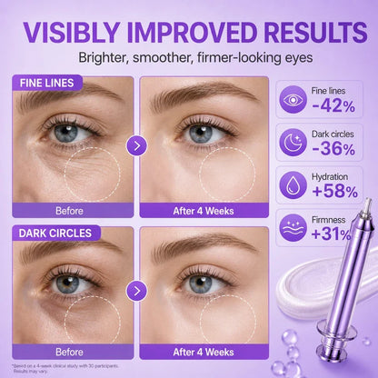 No.9 NAD+ Retinol Volumizing Eye Cream – Targets Dark Circles, Puffiness, Crow’s Feet & Fine Lines with 50 Peptides, 4% Niacinamide and Ceramide, 0.33 fl oz