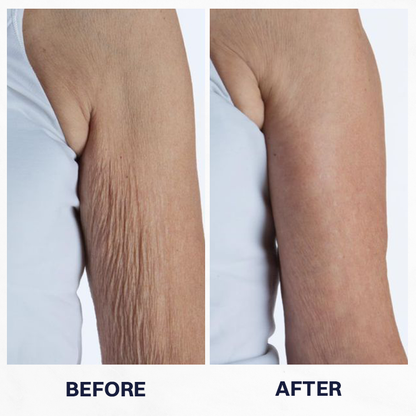 ✨Buy 1 Get 1 Free✨White Tomato Renewal Cream