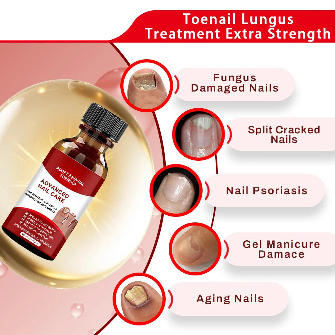 Advanced Nail Care Solution For Fingernails & Toenails – Nail Repair Treatment✨