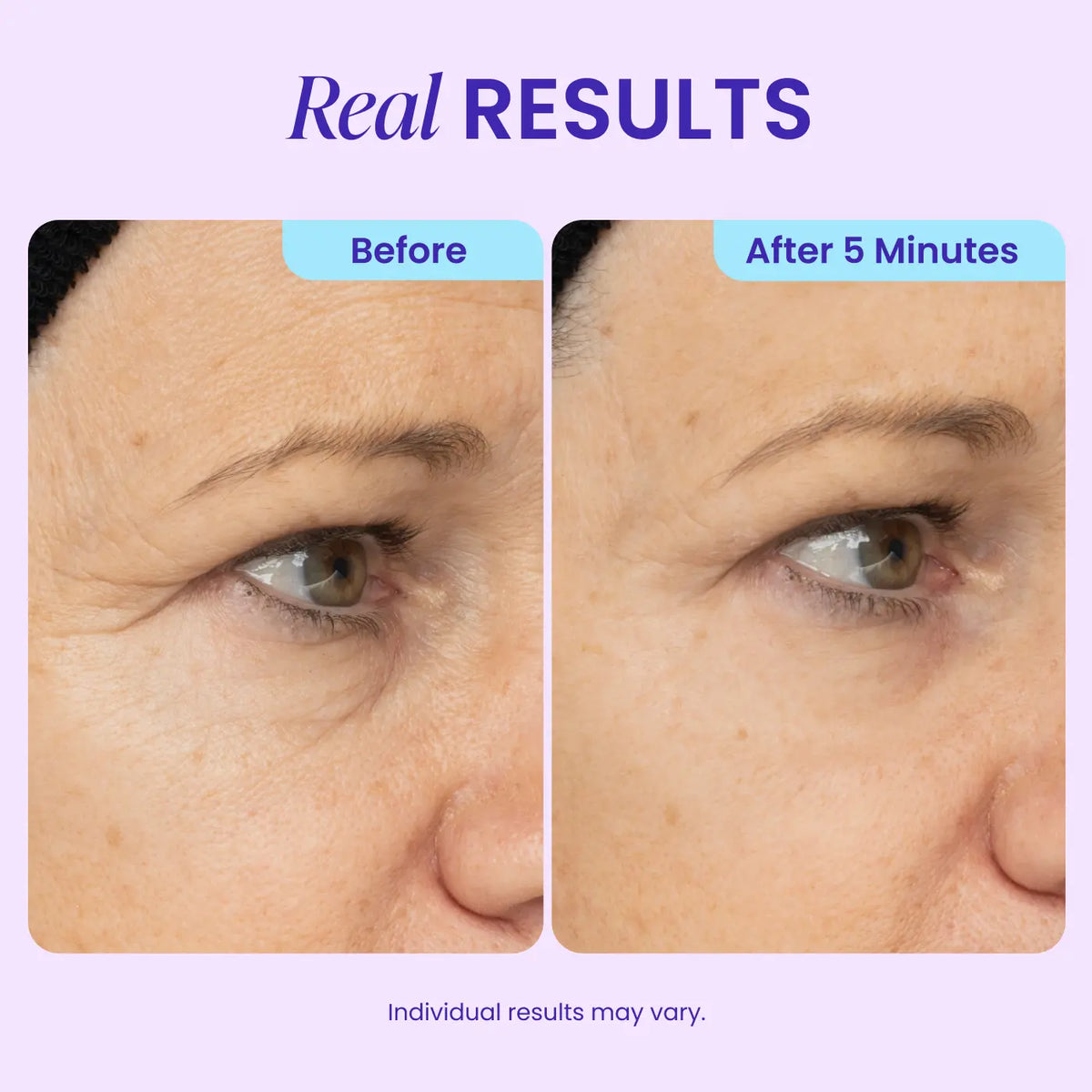 Instant Lift Eye Gel for Puffiness & Wrinkles RESULTS IN AS LITTLE AS 5 MINUTES