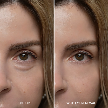 EYE RENEWAL Retinol + Caffeine Eye Cream – Smoother-Looking Under-Eyes & Transparent Finish