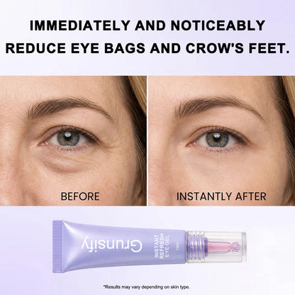 Instant Refresh Eye Gel — Reduce the Look of Eye Bags in Minutes 🔥