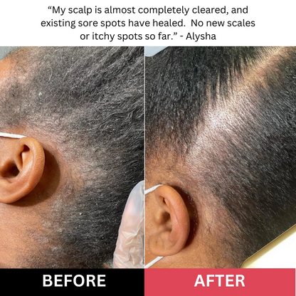 🔥Last Day - Buy 2 Get 1 Free！Revive + Restore Scalp Care | 150ml