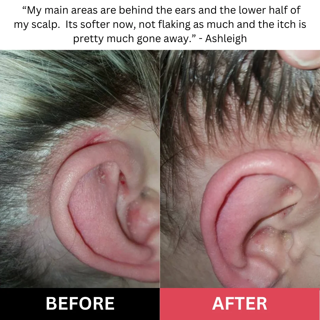 🔥Last Day - Buy 2 Get 1 Free！Revive + Restore Scalp Care | 150ml