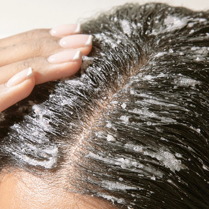 🔥Last Day - Buy 2 Get 1 Free！Revive + Restore Scalp Care | 150ml