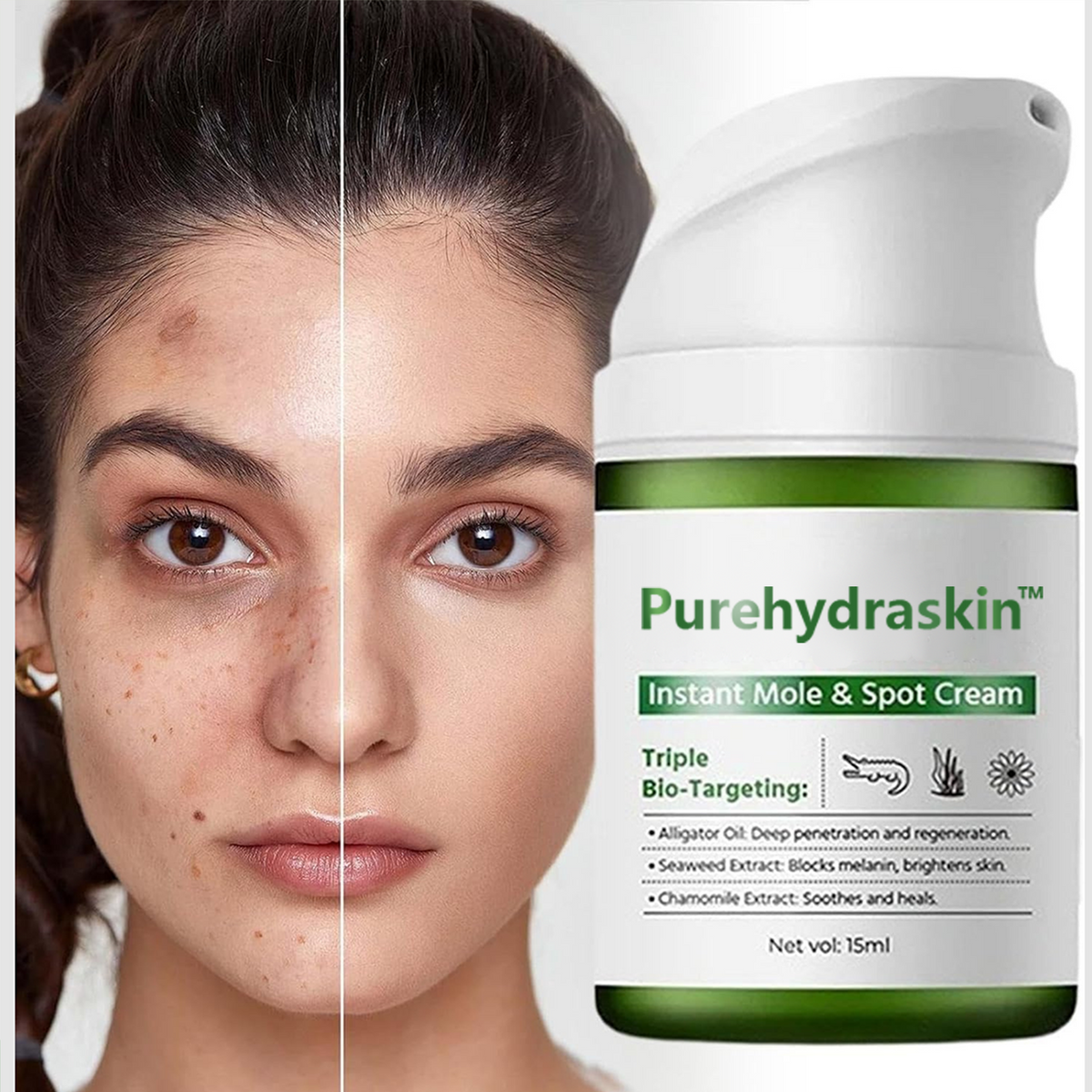 Nature Instant Mole& Spot Cream Fades Moles, Spots & Discoloration at the Source