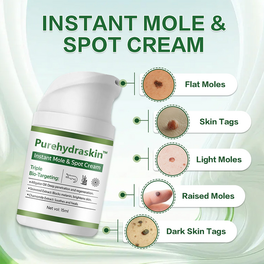 Nature Instant Mole& Spot Cream Fades Moles, Spots & Discoloration at the Source